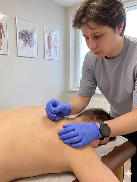 Fizjoterapeuta podczas zabiegu igłoterapii